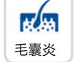 毛囊炎