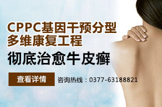 银屑病（牛皮癣）治疗方法