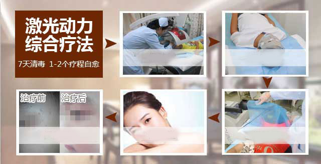扁平疣（瘊子）能不能根治(图3)
