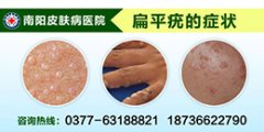 多年扁平疣 终于治好了