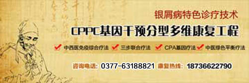 治疗牛皮癣更省钱 南阳白癜风医院帮你忙(图2)