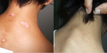 MDR多维双向辩证康复工程七大诊疗技术(图3) MDR多维双向辩证康复工程七大诊疗技术(图3)