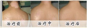  德国Waldma_311纳米治疗系统(图2)