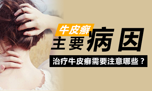 导致牛皮癣发病原因(图1) 南阳皮肤病医院
