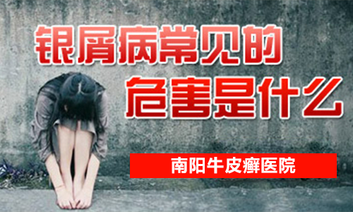 牛皮癣危害大吗(图1) 南阳皮肤病医院
