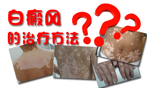 南阳皮肤病医院