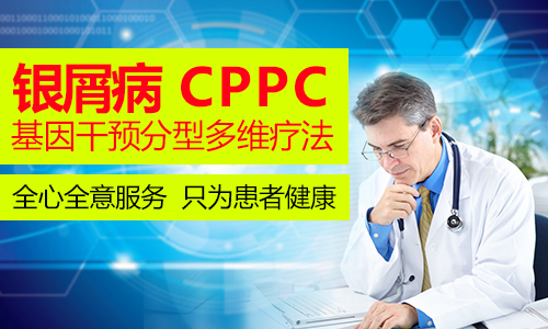 银屑病去哪里治疗好(图1) 南阳皮肤病医院