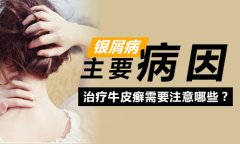 引发银屑病的原因