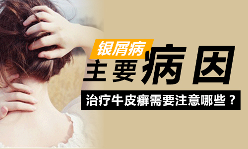 引发银屑病的原因(图1) 南阳皮肤病医院