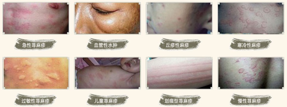 南阳皮肤病医院