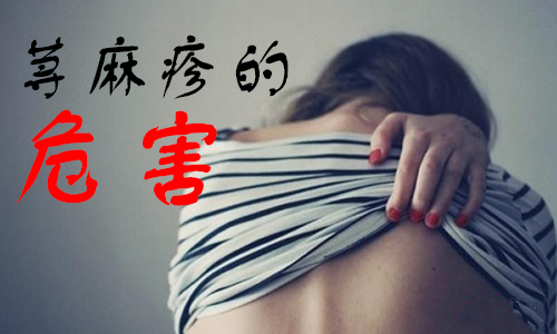 荨麻疹对身体有害吗(图1) 南阳皮肤病医院