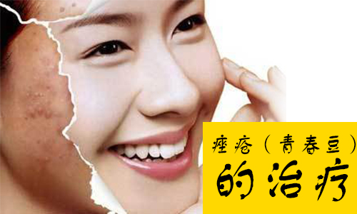 痤疮怎么治疗(图1) 南阳皮肤病医院