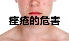 长青春痘有什么危害