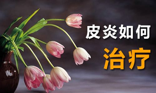 皮炎能治吗(图1) 南阳皮肤病医院