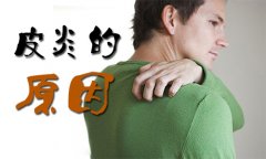 皮炎是什么原因造成的