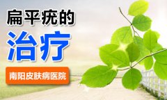 扁平疣可以彻底治好吗