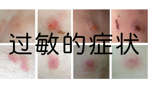 南阳皮肤病医院