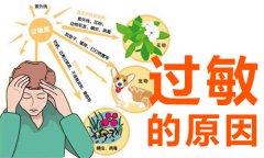 过敏原因有哪些