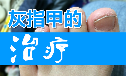 灰指甲用什么药好(图1) 南阳皮肤病医院