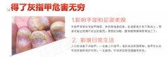灰指甲有哪些危害