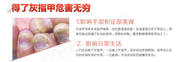 南阳皮肤病医院