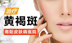 黄褐斑能治吗