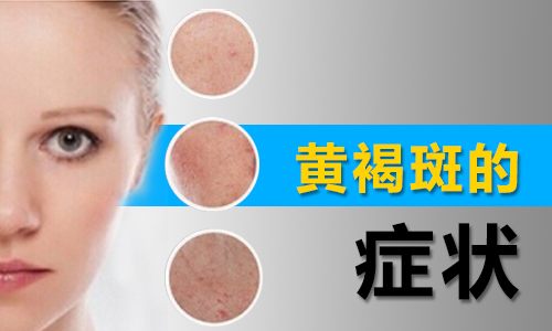 南阳皮肤病医院