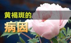 黄褐斑产生的原因