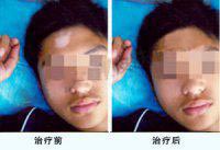 名医专家解读白癜风五大症状(图2)