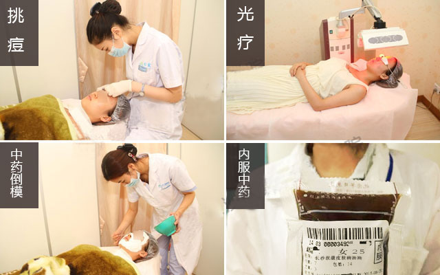 不同类型青春痘的症状及治疗费用(图3)