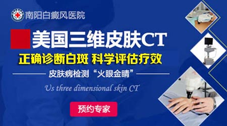 关爱儿童/青少年白癜风，南阳白癜风医院携手首都医科大学附属儿童医院教授，爱心亲诊!(图3)